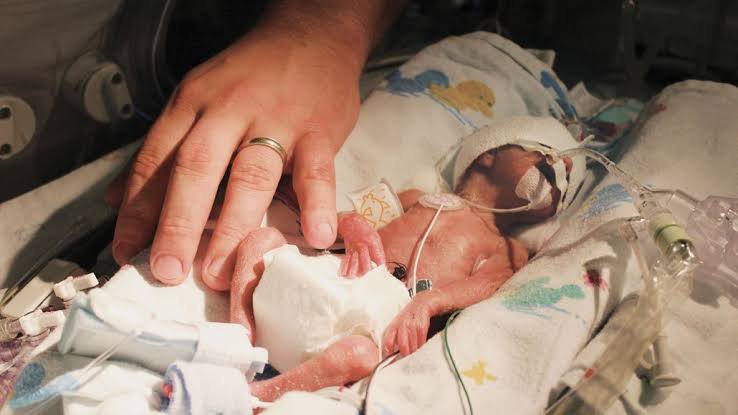 Premature Birth