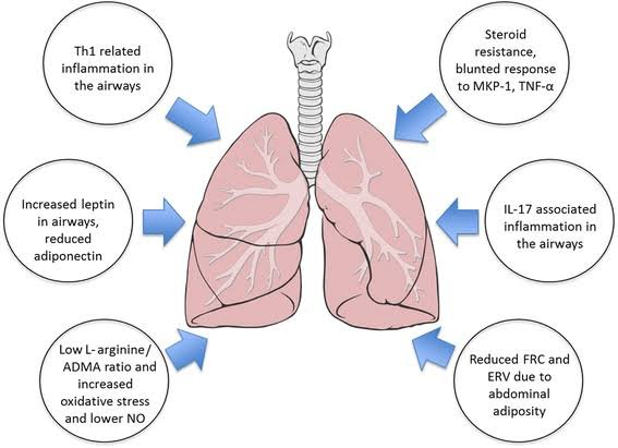 Connection Between Obesity and Asthma